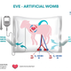 The artificial womb system, “EVE,” used to incubate lambs. IMAGE: Women and Infants Research Foundation